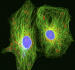 Ilustrační foto - Rakovinné buňky s průměrem okrouhlých jader asi 12 mikrometrů ve speciálním mikroskopu na zkoumání živých buněk. Ilustrační foto.