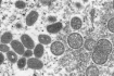 Ilustrační foto - Částice viru opičích neštovic na snímku z elektronového mikroskopu z roku 2003.