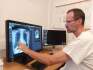 Primář radiodiagnostického oddělení Nemocnice Šumperk Jiří Gerold ukazuje, jak umělá inteligence analyzovala snímek hrudníku pacienta, 17. srpen 2023, Šumperk.