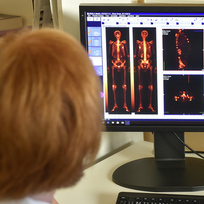Ilustrační foto - Výsledky vyšetření pacienta na tomografu. Ilustrační foto. 