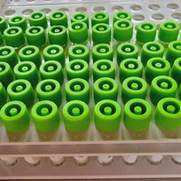 Ilustrační foto - Vzorky odebrané pro PCR testování na koronavirus - ilustrační foto.
