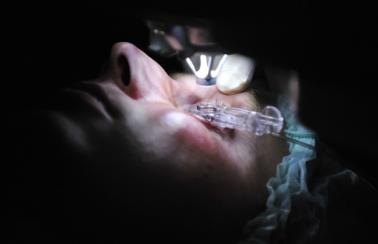 I medici di Torino, in Italia, hanno ripristinato la vista di un uomo di 83 anni con un’operazione unica